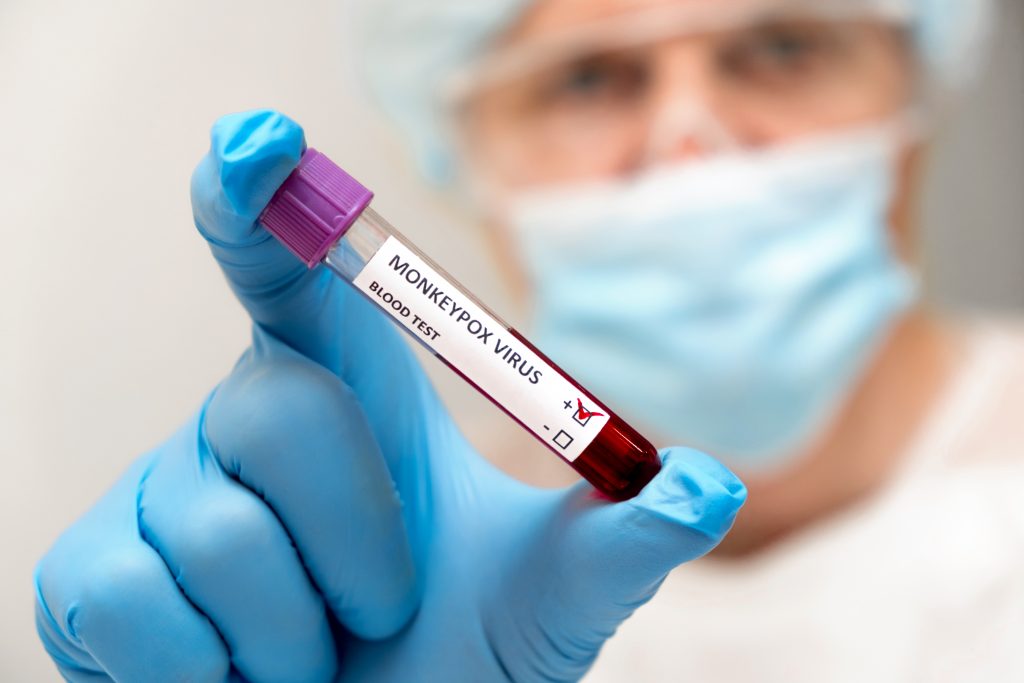 Ministério da Saúde irá divulgar o calendário de vacinação contra a varíola dos macacos.