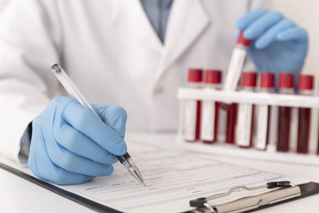 Exames HIV para pacientes não acompanhados no ICOM